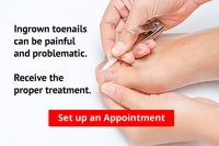 Are You Suffering from Ingrown Toenails?