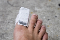 How a Broken Toe Can Affect Your Balance