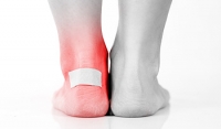 What Causes Blisters on the Feet?